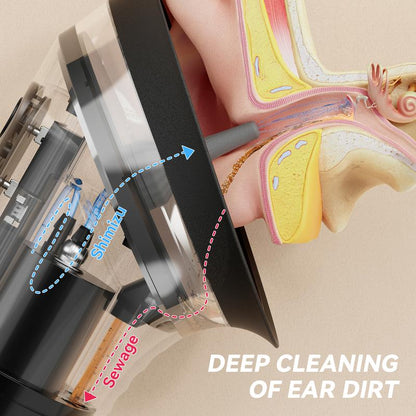 Jeanket Upgraded 2-in-1 Ear Wax Removal Kit with Built-in Waste Tank
